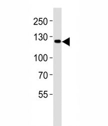 JAK2 Antibody
