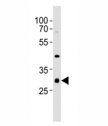 CDK5 Antibody