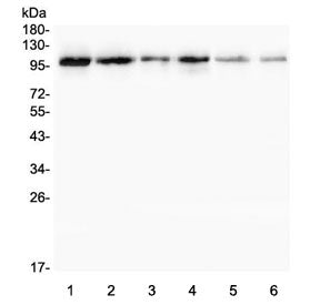 Western blot testing of 1) rat testis, 2) rat thymus, 3) rat spleen, 4) rat lung, 5) mouse testis an