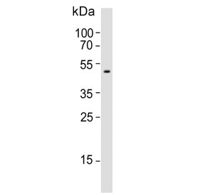 Western blot testing of human blood plasma lysate with Pigment epithelium-derived factor antibody. P