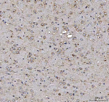 IHC staining of FFPE mouse brain tissue with MAP1S antibody. HIER: boil tissue sections in pH8 EDTA 