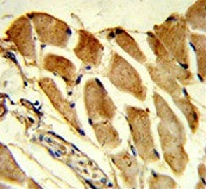 IHC testing of FFPE human skeletal muscle tissue with FHL1 antibody. HIER: steam section in pH6 citr