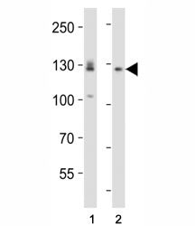 Western blot analysis of lysate from (1) A431 and (2) U-87 MG cell line using EPHA2 antibody diluted