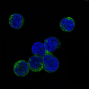 JAK2 Antibody (pY1007/pY1008)