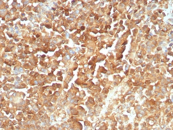 NGF Receptor Antibody / p75NTR / CD271