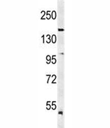 Western blot analysis of KDR antibody and mouse lung tissue lysate. Predicted molecular weight: ~152