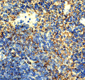 Immunohistochemical staining of ICAM1 using anti-ICAM1 antibody. ICAM1 was detected in a paraffin-em