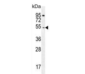 Western blot testing of human Jurkat cell lysate with DARS1 antibody. Predicted molecular weight ~57