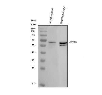 Western blot analysis of Zebrafish Cct5 protein using Zebrafish Cct5 antibody with 1) zebrafish head