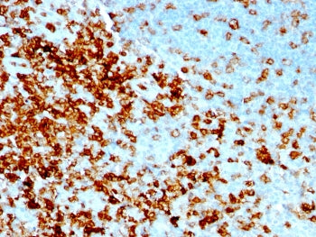 IHC testing of FFPE human tonsil with recombinant CD43 antibody (clone rSPN/1094). Required HIER: bo