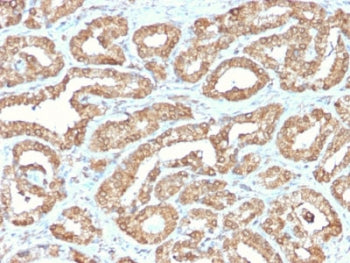 IHC staining of FFPE human prostate tissue with recombinant ODC1 antibody. HIER: boil tissue section