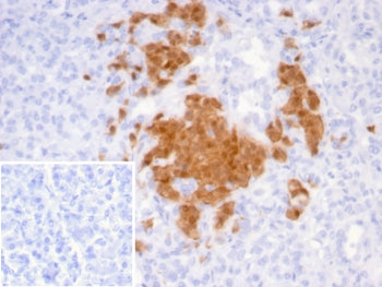 IHC staining of FFPE human pancreas tissue with Secretagogin antibody (clone SCGN/7321). Inset: PBS 