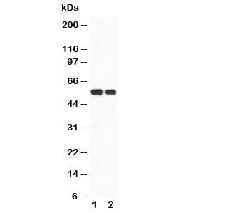 Western blot testing of CaMKK antibody and Lane 1: rat brain; 2: mouse brain