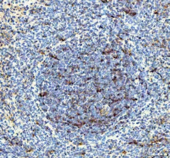 IHC staining of FFPE rat spleen tissue with IL-18 antibody. HIER: boil tissue sections in pH8 EDTA f