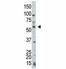 PTEN Antibody