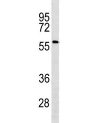 ACSF2 Antibody / Acyl-CoA synthetase family member 2