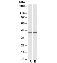 Western blot testing of mouse [A] and rat [B] testis lysates with GNAQ antibody at 0.1ug/ml. Predict