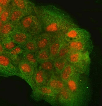 Regulator of G-protein signaling 9 Antibody / RGS9