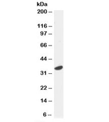 Western blot testing of HeLa lysate with ATF7 antibody at 0.5ug/ml. Predicted molecular weight: isof
