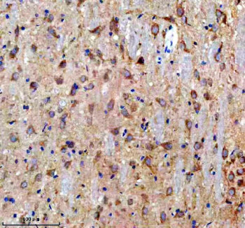DCLK1 Antibody / Doublecortin-like kinase 1, 100ug