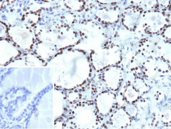 IHC staining of FFPE human thyroid tissue with NKX2.1 antibody (clone NX2.1/9033). Inset: PBS used i
