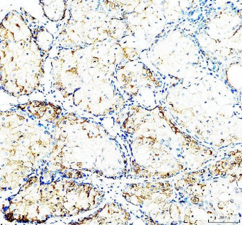 IHC staining of FFPE human teratoma tissue with CD24 antibody, HRP-labeled secondary and DAB substra