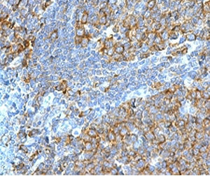 RPSA Antibody / 40S Ribosomal protein SA