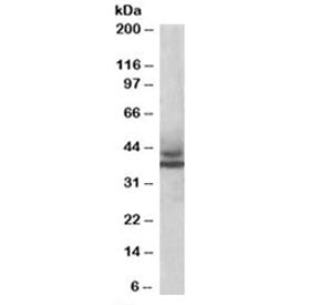 Western blot testing of human muscle lysate with MURF3 antibody at 1ug/ml. Predicted molecular weigh