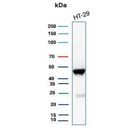 Western blot testing of human HT29 cell lysate with recombinant Cytokeratin 20 antibody. Predicted m