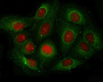 Angiogenin Antibody