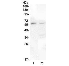 Western blot testing of human 1) placenta and 2) 293T lysate with CSF1 antibody at 0.5ug/ml. Predict