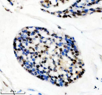 HTATSF1 Antibody / HIV Tat-specific factor 1, 100ul