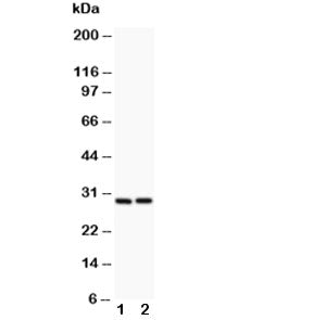 Western blot testing of Bcl2A1 antibody and (1) HeLa, (2) Jurkat lysate. Predicted molecular weight: