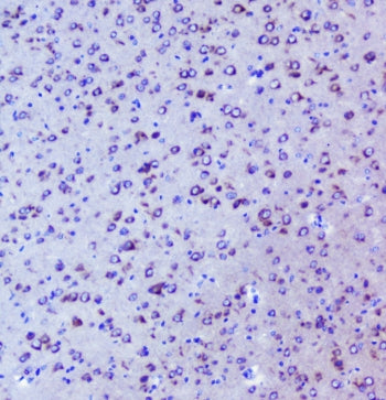 IHC staining of FFPE mouse brain with Igf2r antibody at 1ug/ml. HIER: boil tissue sections in pH6, 1