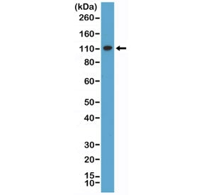 Western blot testing of human HeLa cell lysate with recombinant MSH2 antibody at 1:1000 dilution. Ex