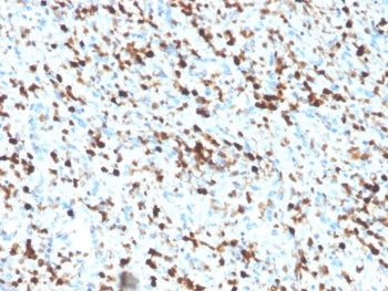 IHC staining of FFPE human spleen tissue with S100A4 antibody (clone S100A4/6802). Inset: PBS used i