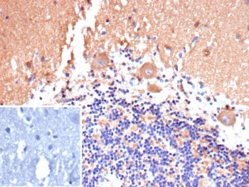 IHC staining of FFPE human brain tissue with CD135 antibody (clone FLT3/9889). Inset: PBS used in pl