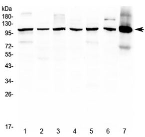 Western blot testing of 1) rat brain, 2) rat lung, 3) rat testis, 4) mouse lung, 5) mouse brain, 6) 