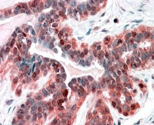 IHC testing of FFPE human breast with SNX12 antibody at 4ug/ml. HIER: steamed with pH6 citrate buffe