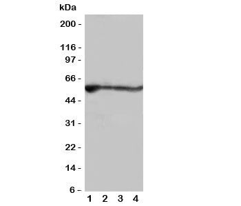 Western blot testing of ALDH2 antibody and rat samples; Lane 1: liver; 2: intestine; 3: lung; 4: kid