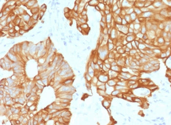 IHC testing of FFPE human colon tissue with recombinant Cytokeratin 19 antibody (clone CTKN19-2R). R