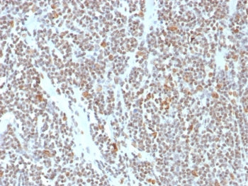 IHC staining of FFPE human colon tissue with ATRX antibody (clone ATRX/7940). HIER: boil tissue sect