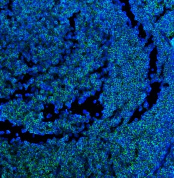 CD45 Antibody