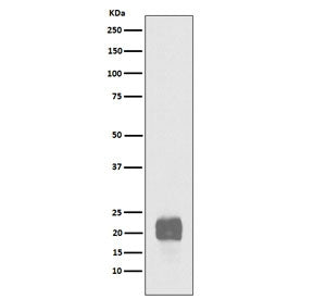 Western blot testing of human NCCIT cell lysate with recombinant CRIPTO antibody. Predicted molecula