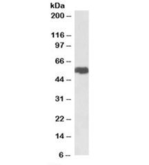 Western blot testing of breast cancer lysate with SLC40A1 antibody at 1ug/ml. Predicted molecular we