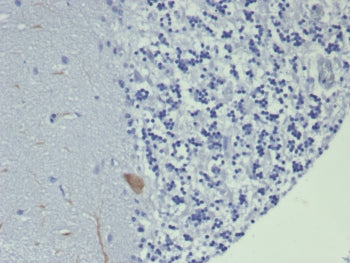 IHC staining of FFPE human brain tissue with GIRK2 antibody (clone KCNJ6/7559) at 2ug/ml. HIER: boil