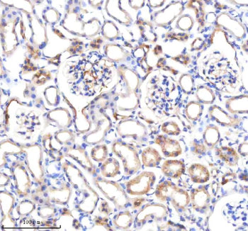 Immunohistochemical staining of P3H2 using anti-P3H2 antibody. P3H2 was detected in a paraffin-embed
