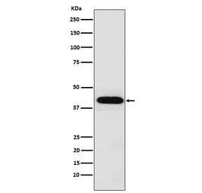 Western blot testing of human HeLa cell lysate with INHA antibody. Predicted molecular weight ~40 kD