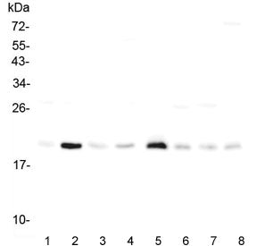 Western blot testing of rat 1) heart, 2) lung, 3) stomach, 4) kidney and mouse 5) heart, 6) lung, 7)