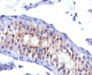 Prolactin Receptor Antibody / PRLR